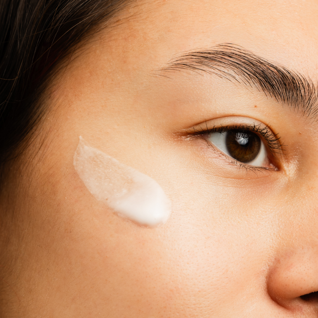 Crème anti-imperfections