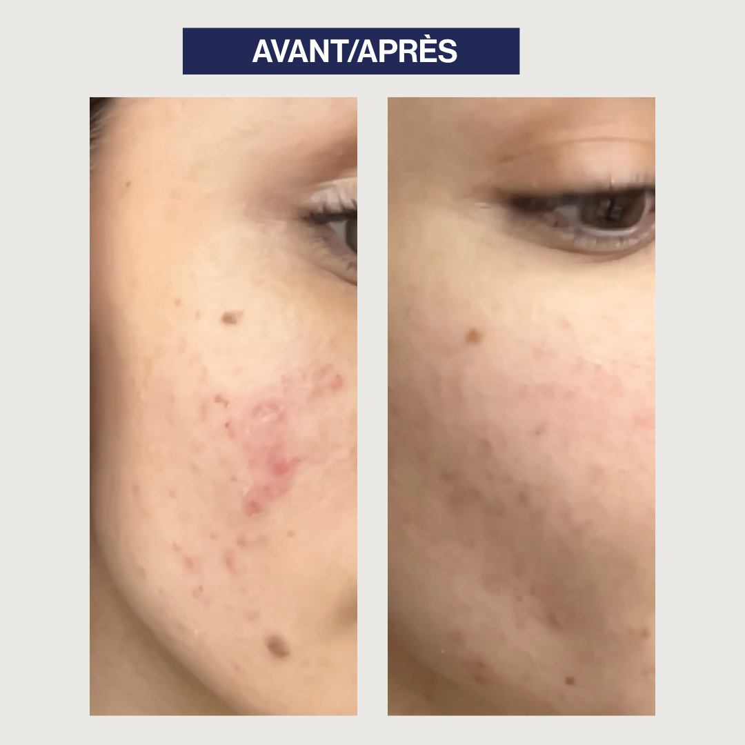 Universal radiance exfoliating cleansing gel