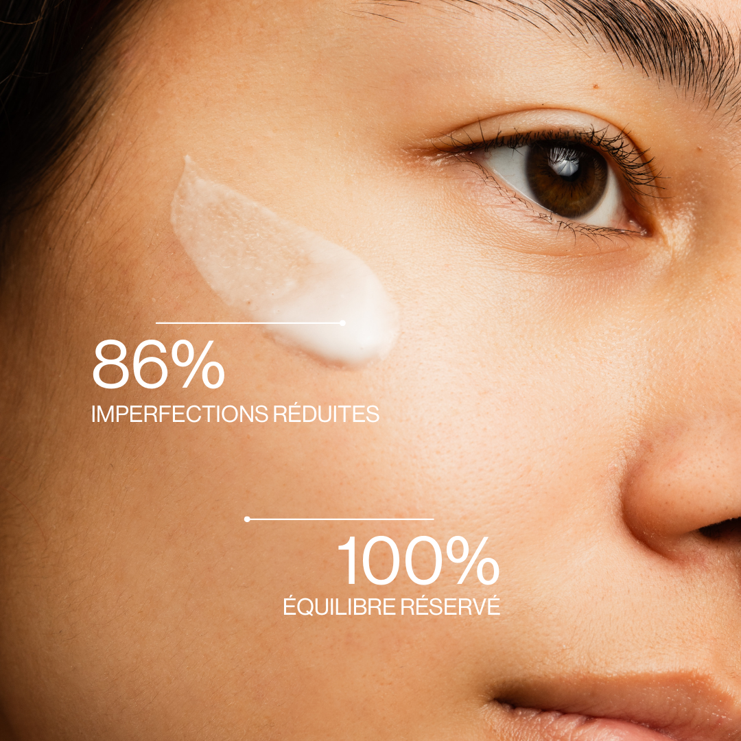 Anti-blemish treatment