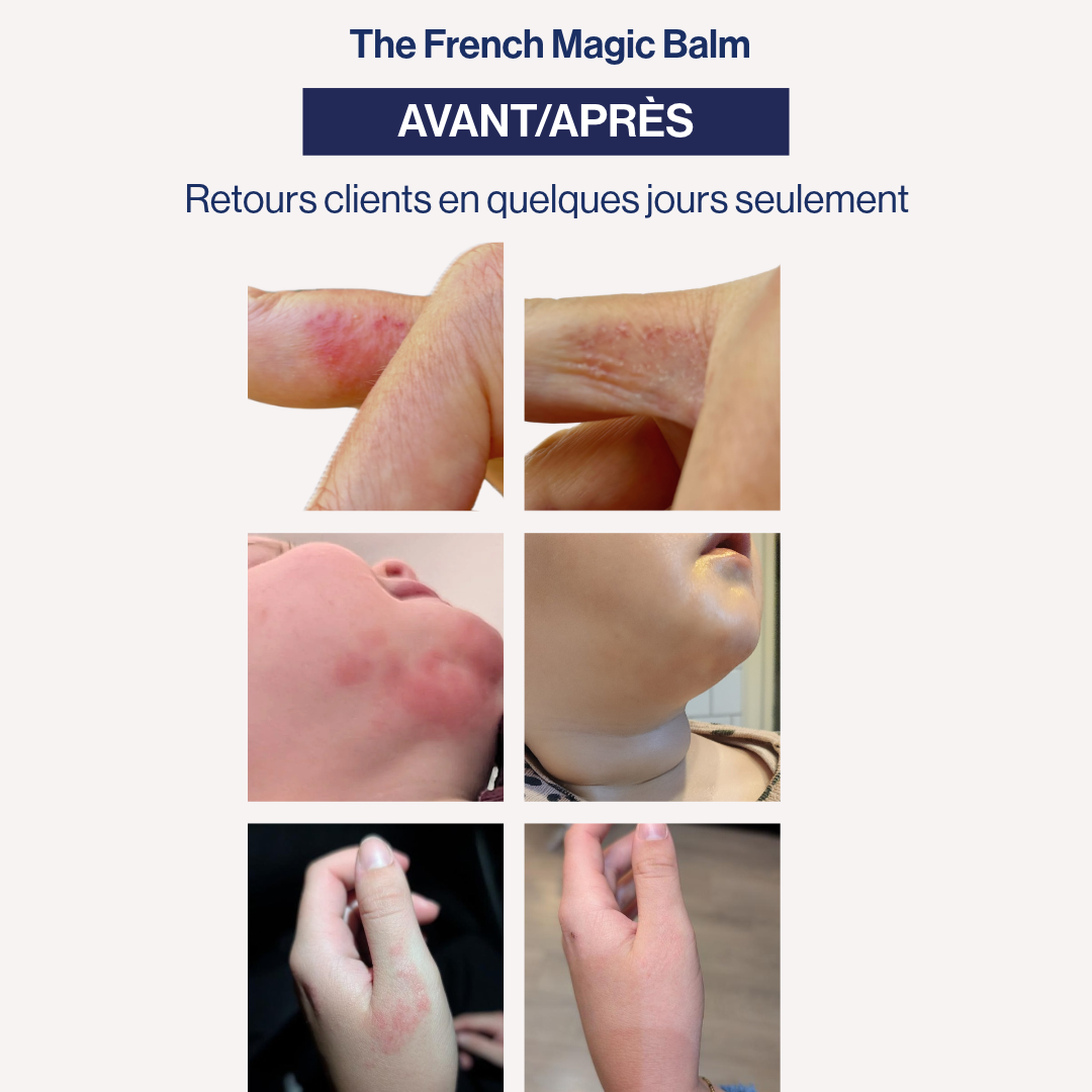 Baume Multi-Usage + Baume à Lèvres